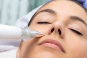 Best Actinic Keratoses Removal 3 Actinic keratoses Beeston Hill solutions - book in today!