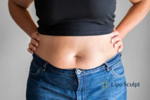 Do you wish you could reduce your muffin top Beeston Hill With Aqualy fat dissolving injections you can!
